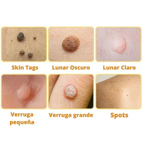 DERMABEE - Tratamiento con veneno de abeja