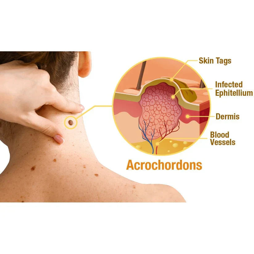 DERMABEE - Tratamiento con veneno de abeja